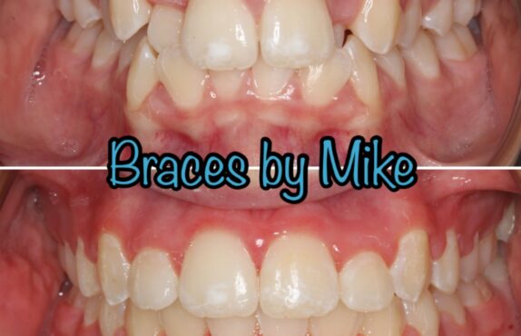 Before - Dr Michael Durkan