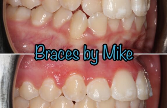 After - Dr Michael Durkan