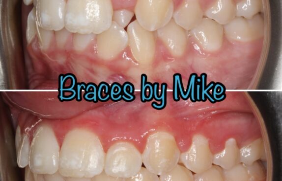 Before - Dr Michael Durkan