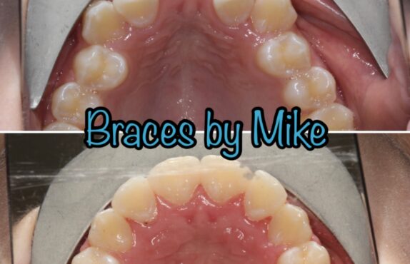 Before - Dr Michael Durkan