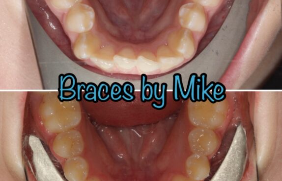 Before - Dr Michael Durkan